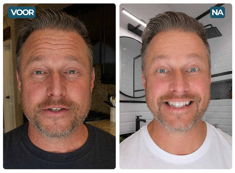Dávid, 49 — pred / po
