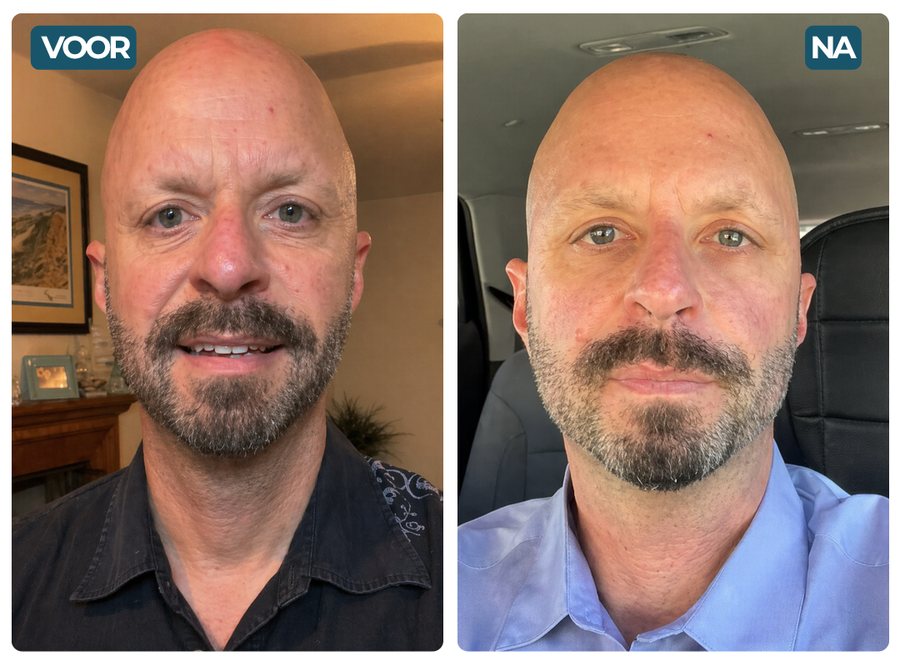 Zdenko, 58 — pred / po
